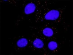 CrkL Antibody (4B5), Novus Biologicals 0.1 mg | Buy Online | Novus Biologicals | Fisher Scientific