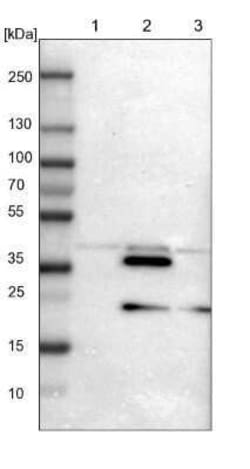 CrkL Antibody, Novus Biologicals 25 &mu;L; Unconjugated:Antibodies, Polyclonal