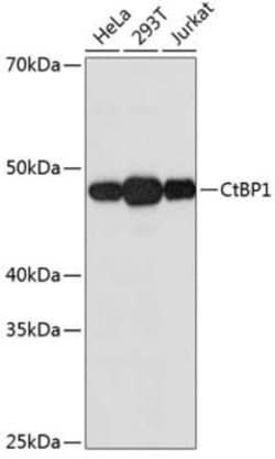 CtBP1 Rabbit anti-Human, Mouse, Rat, Clone: 1I7G6, Novus Biologicals 100 &mu;g | Buy Online | Novus Biologicals | Fisher Scientific