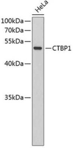 CtBP1 Antibody - Azide and BSA Free, Novus Biologicals 0.02 mL | Buy Online | Novus Biologicals | Fisher Scientific