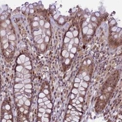 CtIP Antibody, Novus Biologicals 25 &mu;L; Unconjugated:Antibodies, Polyclonal