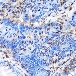 Ctip1 Rabbit anti-Human, Mouse, Rat, Clone: 3M8M3, Novus Biologicals:Antibodies:Primary