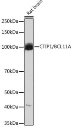 Ctip1 Rabbit anti-Human, Mouse, Rat, Clone: 3M8M3, Novus Biologicals:Antibodies:Primary