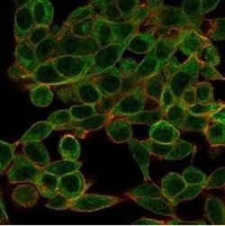 Ctip1 Mouse anti-Human, Clone: PCRP-BCL11A-1G10, Novus Biologicals:Antibodies:Primary