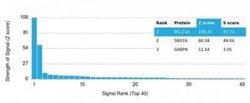 Ctip1 Mouse anti-Human, Clone: PCRP-BCL11A-1G10, Novus Biologicals:Antibodies:Primary
