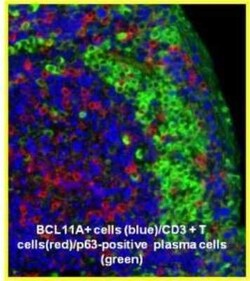 Ctip1 Antibody (BCL11A/123) - BSA Free, Novus Biologicals 0.1 mL | Buy Online | Novus Biologicals | Fisher Scientific