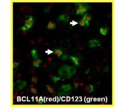 Ctip1 Antibody (BCL11A/123) - BSA Free, Novus Biologicals 0.1 mL | Buy Online | Novus Biologicals | Fisher Scientific