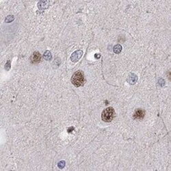 Ctip1 Rabbit anti-Human, Polyclonal, Novus Biologicals:Antibodies:Primary