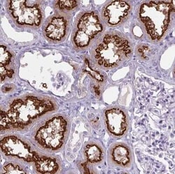 Cubilin Antibody, Novus Biologicals 25ul; Unconjugated:Antibodies, Polyclonal