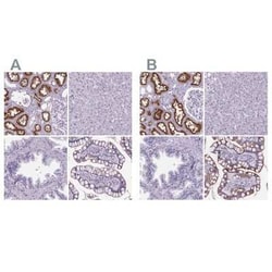 Cubilin Antibody, Novus Biologicals 25ul; Unconjugated:Antibodies, Polyclonal