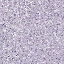 Cubilin Antibody, Novus Biologicals 25ul; Unconjugated:Antibodies, Polyclonal