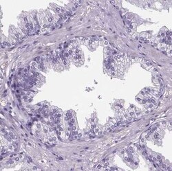 Cubilin Antibody, Novus Biologicals 25ul; Unconjugated:Antibodies, Polyclonal