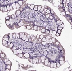 Cubilin Antibody, Novus Biologicals 25ul; Unconjugated:Antibodies, Polyclonal