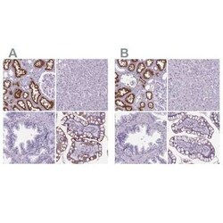 Cubilin Antibody, Novus Biologicals:Antibodies:Primary Antibodies