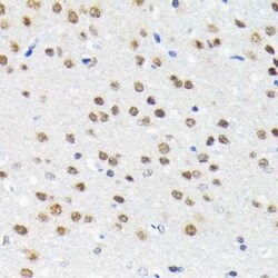 Cullin 3 Rabbit anti-Human, Mouse, Rat, Clone: 7W3E3, Novus Biologicals 20 &mu;g | Buy Online | Novus Biologicals | Fisher Scientific