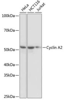 Cyclin A2 Rabbit anti-Human, Mouse, Rat, Clone: 3E9Z3, Novus Biologicals