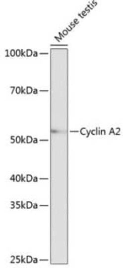 Cyclin A2 Rabbit anti-Human, Mouse, Rat, Clone: 3E9Z3, Novus Biologicals