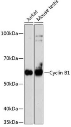 Cyclin B1 Rabbit anti-Human, Mouse, Clone: 1Q3E9, Novus Biologicals:Antibodies:Primary