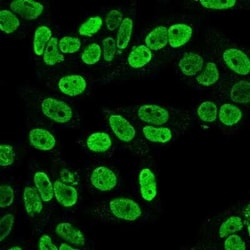 Cyclin B1 Antibody (SPM619), Novus Biologicals:Antibodies:Primary Antibodies