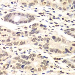 Cyclin C Antibody - BSA Free, Novus Biologicals:Antibodies:Primary Antibodies