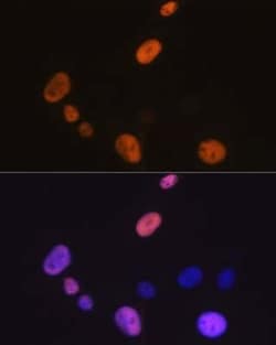 Cyclin D1 Rabbit anti-Human, Mouse, Rat, Clone: 7C8Z4, Novus Biologicals 20 &mu;g | Buy Online | Bio-Techne | Fisher Scientific