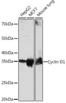 Cyclin D1 Rabbit anti-Human, Mouse, Rat, Clone: 7C8Z4, Novus Biologicals 20 &mu;g | Buy Online | Bio-Techne | Fisher Scientific