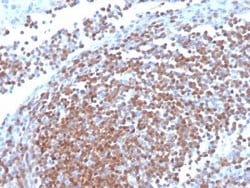 Cyclin D1 Antibody (CCND1/3370R) - Azide and BSA Free, Novus Biologicals 100 &mu;g | Buy Online | Novus Biologicals | Fisher Scientific