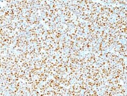 Cyclin D1 Antibody (DCS-6), Novus Biologicals:Antibodies:Primary Antibodies