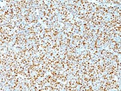 Cyclin D1 Antibody (DCS-6), Novus Biologicals:Antibodies:Primary Antibodies