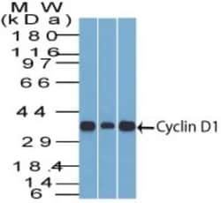 Cyclin D1 Antibody (DCS-6), Novus Biologicals:Antibodies:Primary Antibodies