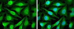 Cyclin D2 Antibody, Novus Biologicals 100 &mu;g; Unconjugated:Antibodies,