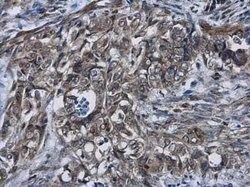 Cyclin D2 Antibody, Novus Biologicals 100 &mu;g; Unconjugated:Antibodies,