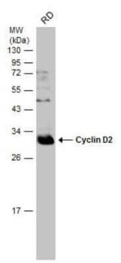 Cyclin D2 Antibody, Novus Biologicals 100 &mu;g; Unconjugated:Antibodies,