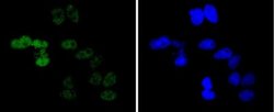 Cyclin E1 Antibody (SD20-24), Novus Biologicals 100&mu;L:Antibodies, Monoclonal