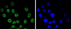 Cyclin E1 Antibody (SD20-24), Novus Biologicals 100&mu;L:Antibodies, Monoclonal