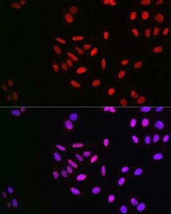 Cyclin E1, p Thr395 Antibody - BSA Free, Novus Biologicals:Antibodies:Primary