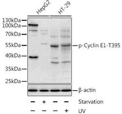 Cyclin E1, p Thr395 Antibody - BSA Free, Novus Biologicals:Antibodies:Primary