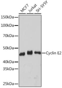 Cyclin E2 Rabbit anti-Human, Clone: 0Y7G5, Novus Biologicals 100 &mu;g | Buy Online | Novus Biologicals | Fisher Scientific