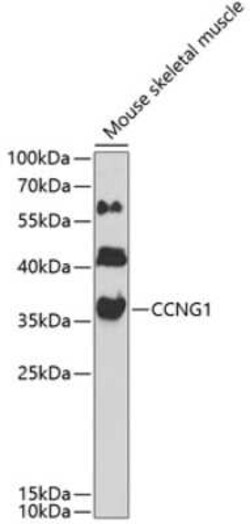 Cyclin G Antibody - BSA Free, Novus Biologicals 0.02 mL, Unconjugated:Antibodies,