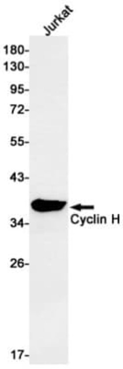 Cyclin H Antibody (S03-0D8), Novus Biologicals 50 &mu;g | Buy Online | Novus Biologicals | Fisher Scientific