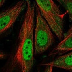 Cyclin T1 Rabbit anti-Human, Polyclonal, Novus Biologicals:Antibodies:Primary