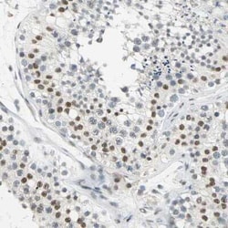 Cyclin T1 Antibody, Novus Biologicals 100 &mu;g; Unconjugated:Antibodies,