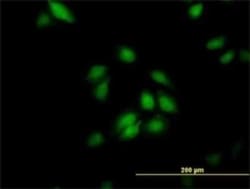 Cyclophilin-E Antibody (2F5), Novus Biologicals 0.1 mg, Unconjugated:Antibodies,