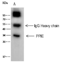Cyclophilin-E Antibody, Novus Biologicals:Antibodies:Primary Antibodies