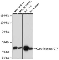 Cystathionase Rabbit anti-Human, Mouse, Rat, Clone: 7L3D0, Novus Biologicals