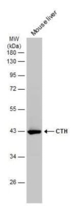 Cystathionase Antibody (GT1657), Novus Biologicals 100 &mu;g | Buy Online | Novus Biologicals | Fisher Scientific