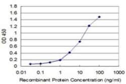 Cystathionase Antibody (2E12-1C10), Novus Biologicals 0.1 mg | Buy Online | Novus Biologicals | Fisher Scientific