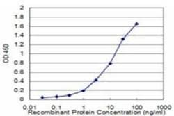 Cystathionase Antibody (4E1-1B7), Novus Biologicals 100 &mu;g | Buy Online | Novus Biologicals | Fisher Scientific