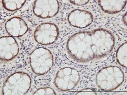 Cystathionase Antibody (4E1-1B7), Novus Biologicals 100 &mu;g | Buy Online | Novus Biologicals | Fisher Scientific