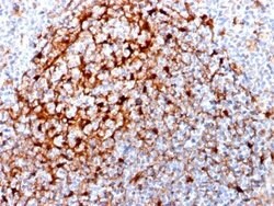 Cystatin A Antibody (CPTC-CSTA-1) - Azide and BSA Free, Novus Biologicals